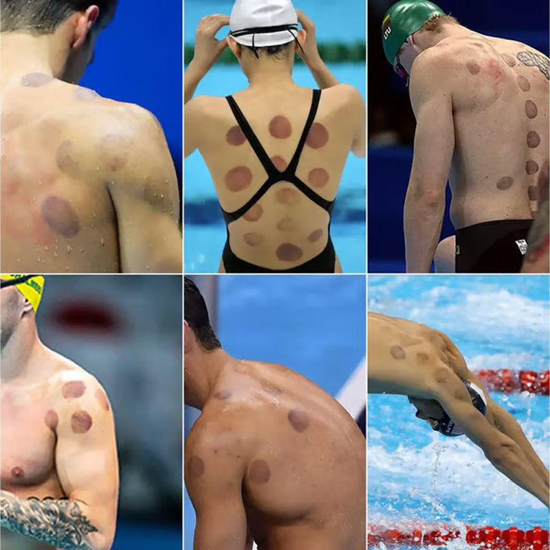 🛡️Sada na vákuové bankovanie so zosilnenými bankami a odsávacou pumpou💪